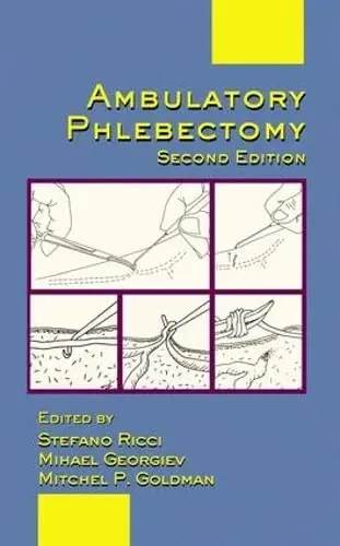 Cover of Ambulatory Phlebectomy, Second Edition