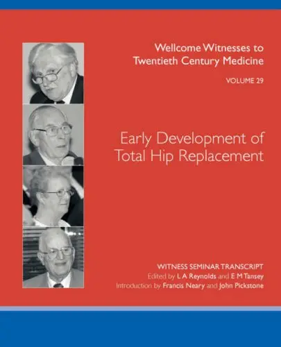 Cover of Early Development of Total Hip Replacement