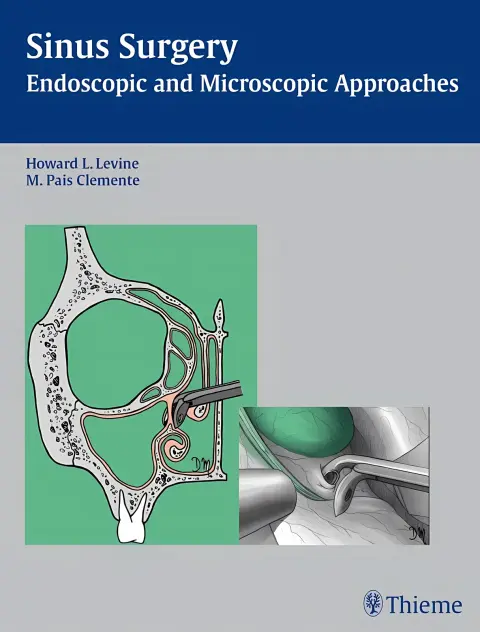 Cover of Sinus Surgery
