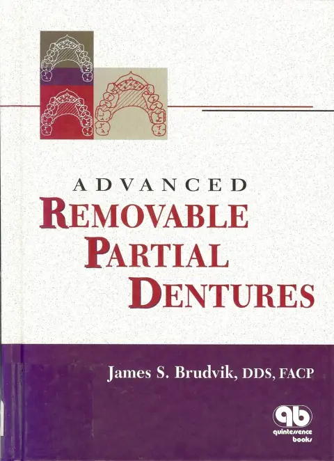 Cover of Advanced Removable Partial Dentures