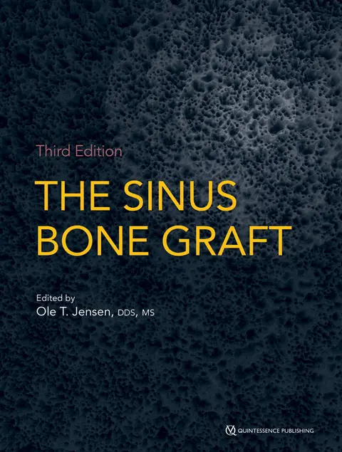 Cover of The Sinus Bone Graft