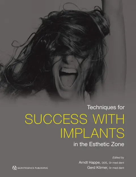 Cover of Techniques for Success with Implants in the Esthetic Zone