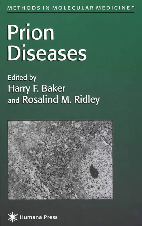 Cover of Prion Diseases
