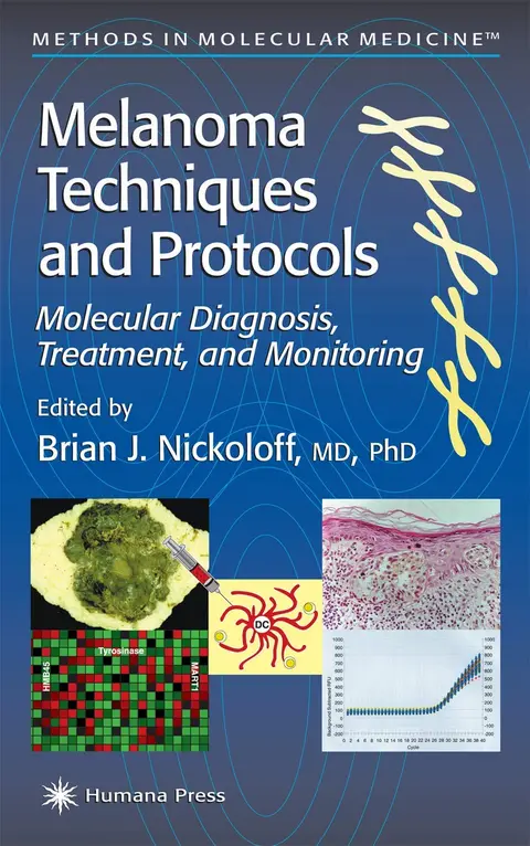 Cover of Melanoma Techniques and Protocols