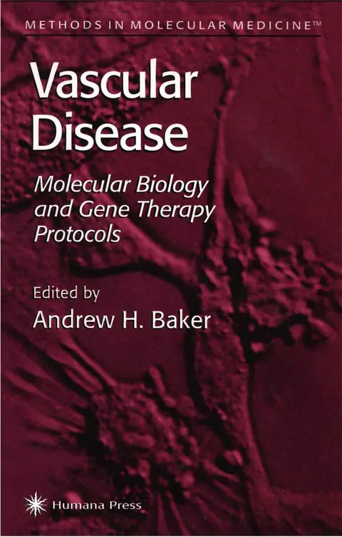 Cover of Vascular Disease