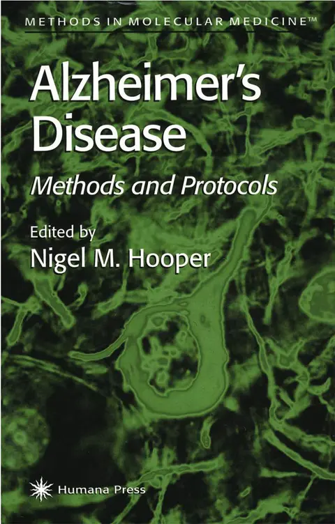 Cover of Alzheimer's Disease