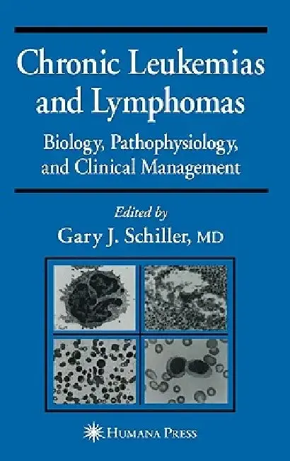 Cover of Chronic Leukemias and Lymphomas