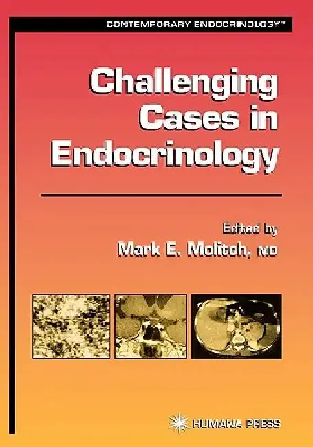 Cover of Challenging Cases in Endocrinology