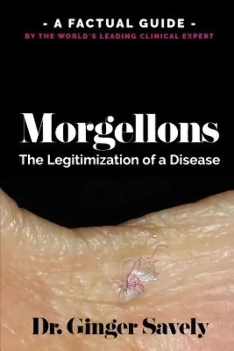 Cover of Morgellons