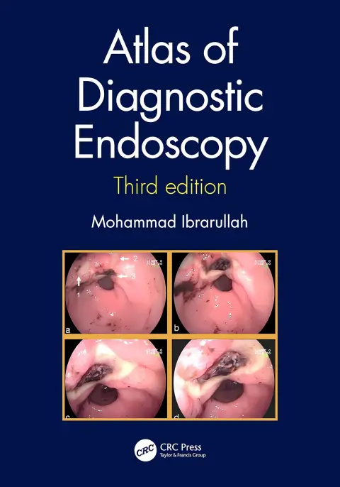 Cover of Atlas of Diagnostic Endoscopy, 3E