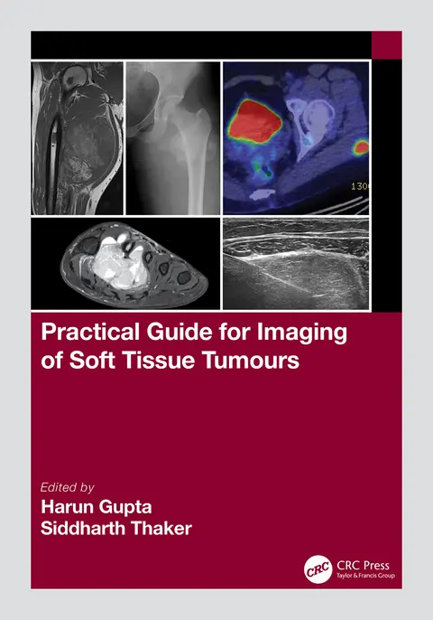 Cover of Practical Guide for Imaging of Soft Tissue Tumours
