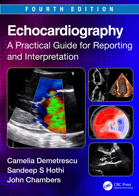 Cover of Echocardiography A Practical Guide for Reporting and Interpretation 4Ed