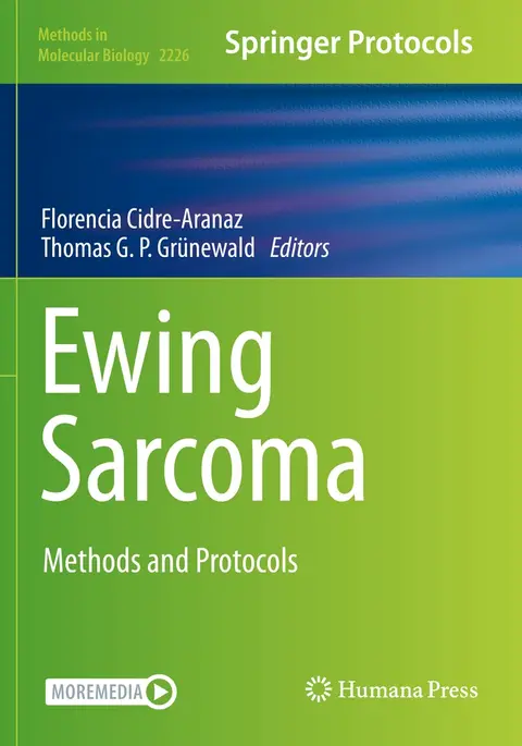 Cover of Ewing Sarcoma