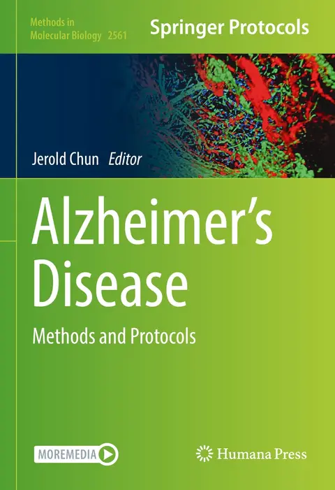 Cover of Alzheimer’s Disease