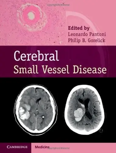 Cover of Cerebral Small Vessel Disease