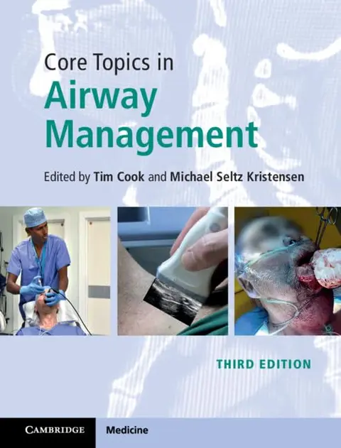 Cover of Core Topics in Airway Management