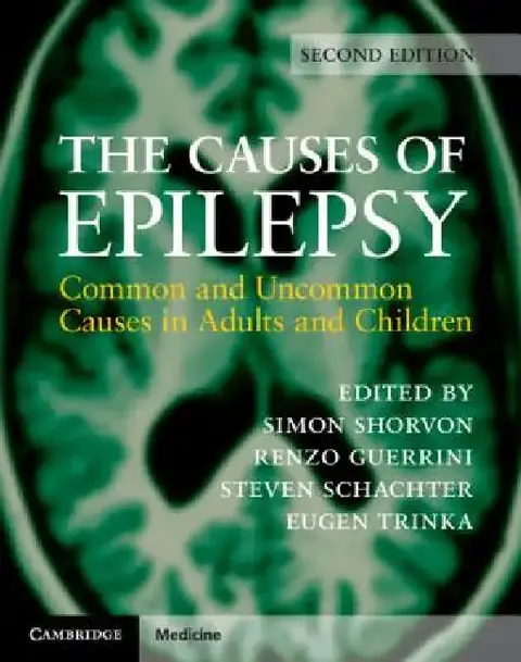 Cover of The Causes of Epilepsy