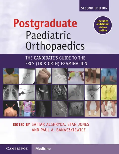 Cover of Postgraduate Paediatric Orthopaedics