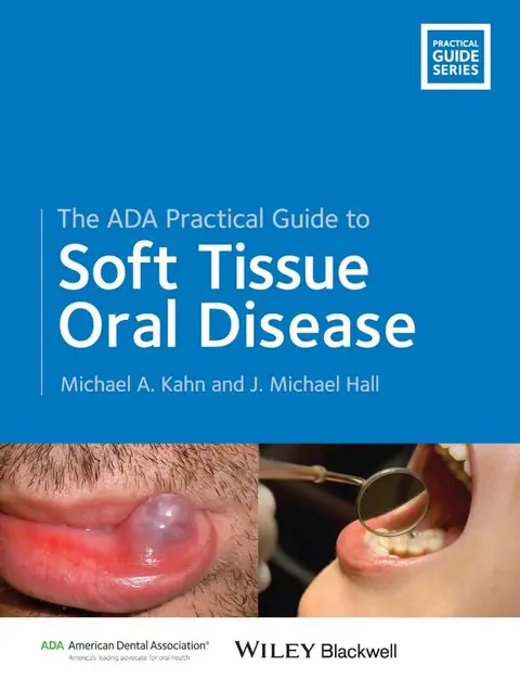 Cover of The ADA Practical Guide to Soft Tissue Oral Disease