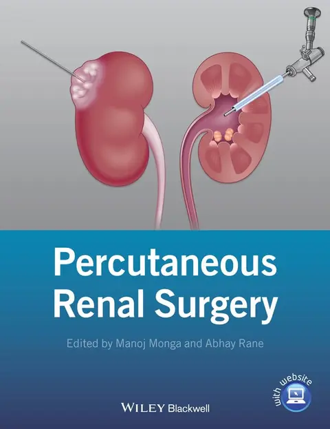 Cover of Percutaneous Renal Surgery