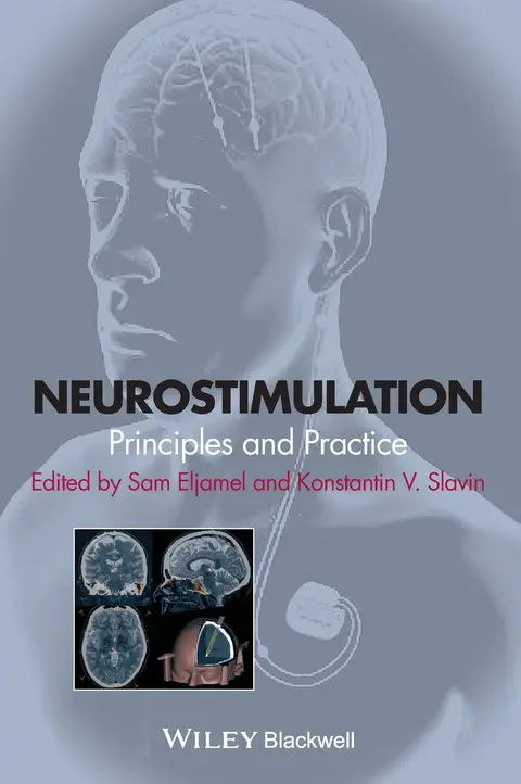 Cover of Neurostimulation