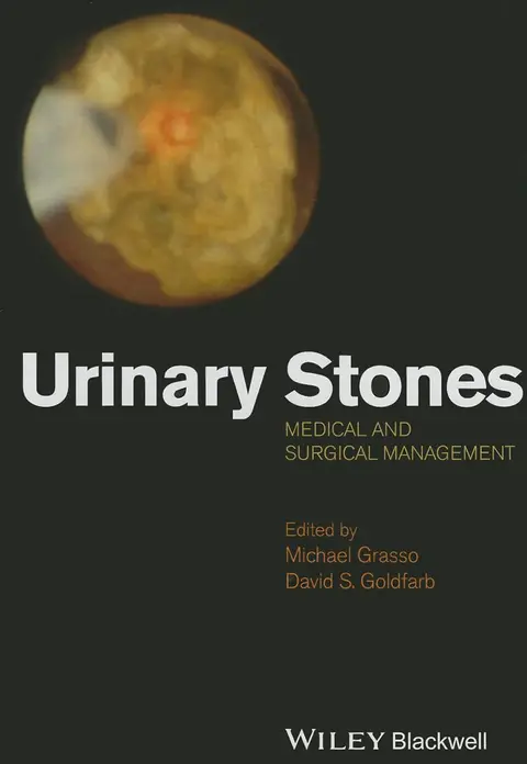Cover of Urinary Stones