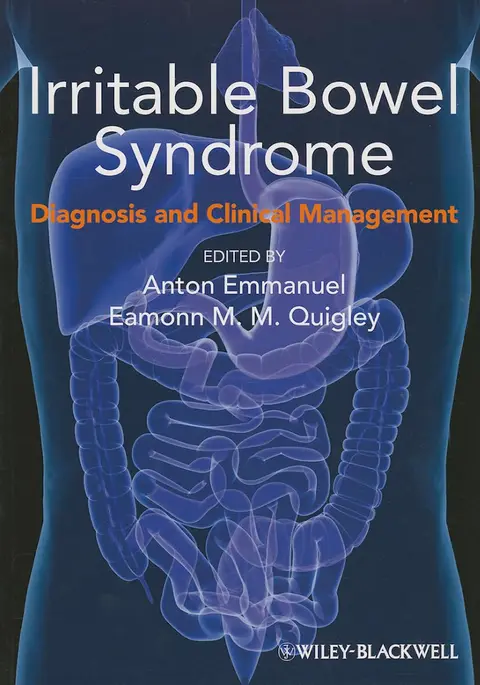 Cover of Irritable Bowel Syndrome