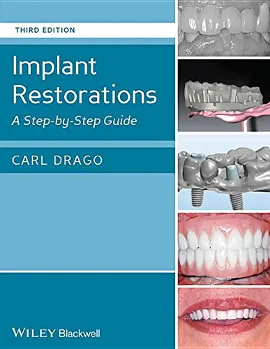 Cover of Implant Restorations