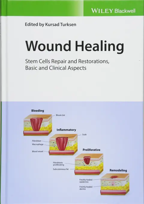 Cover of Wound Healing