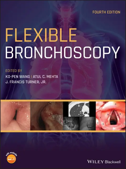 Cover of Flexible Bronchoscopy