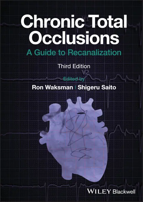 Cover of Chronic Total Occlusions