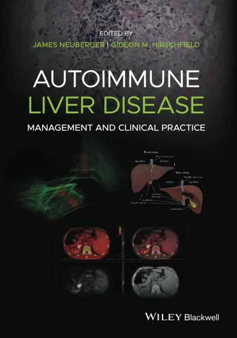 Cover of Autoimmune Liver Disease