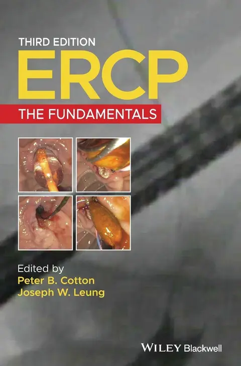 Cover of Ercp