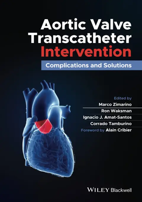 Cover of Aortic Valve Transcatheter Intervention