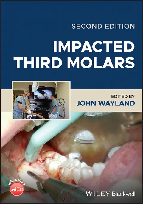 Cover of Impacted Third Molars 2Ed