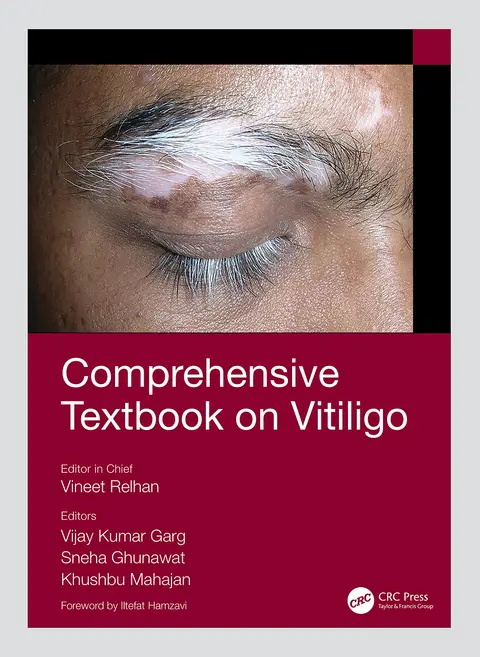 Cover of Comprehensive Textbook on Vitiligo