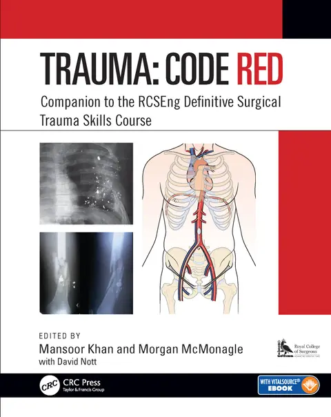 Cover of Trauma