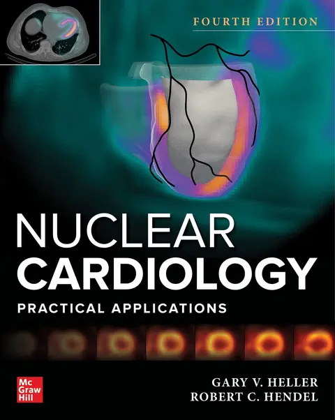 Cover of Nuclear Cardiology