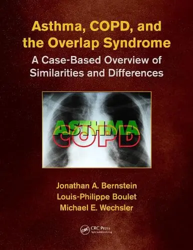 Cover of Asthma, Copd, and Overlap