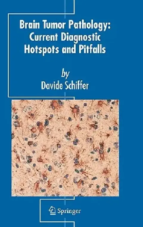 Cover of Brain Tumor Pathology