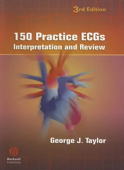 Cover of 150 Practice ECGs