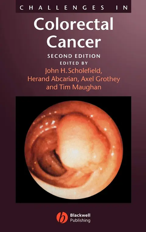 Cover of Challenges in Colorectal Cancer