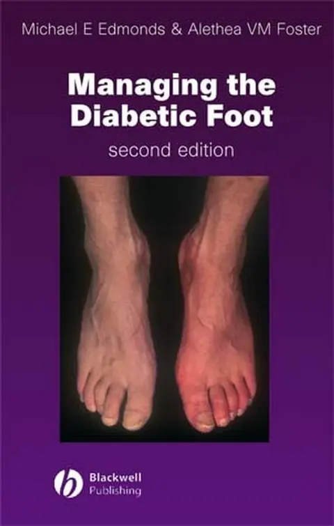 Cover of Managing the Diabetic Foot