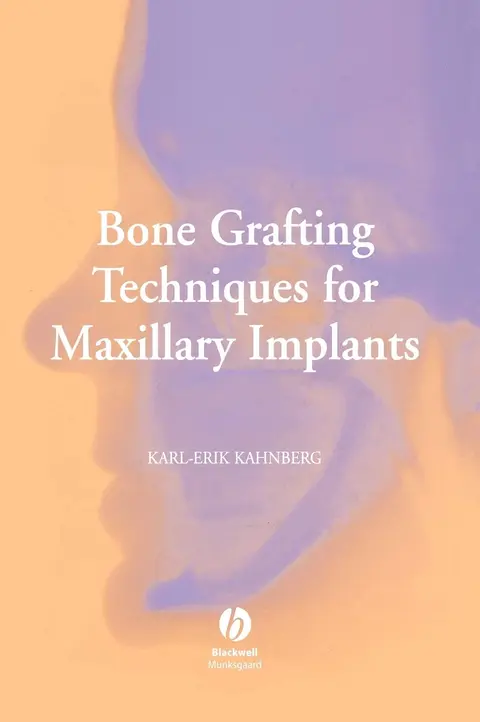 Cover of Bone Grafting Techniques for Maxillary Implants
