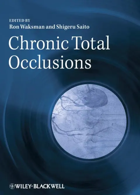 Cover of Chronic Total Occlusions