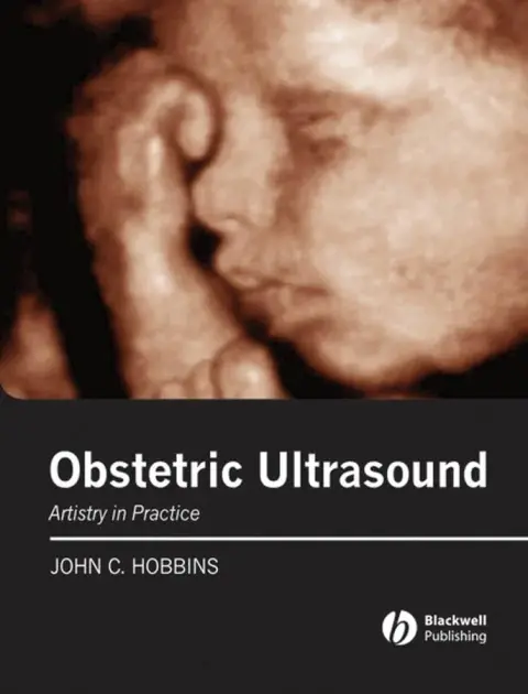 Cover of Obstetric Ultrasound
