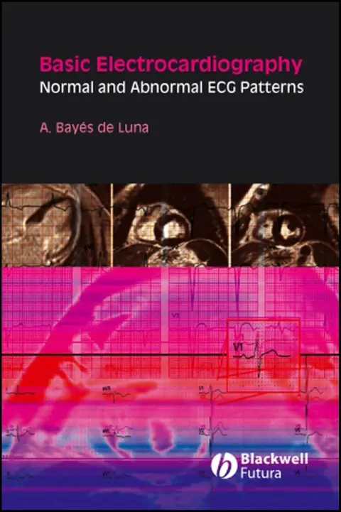 Cover of Basic Electrocardiography