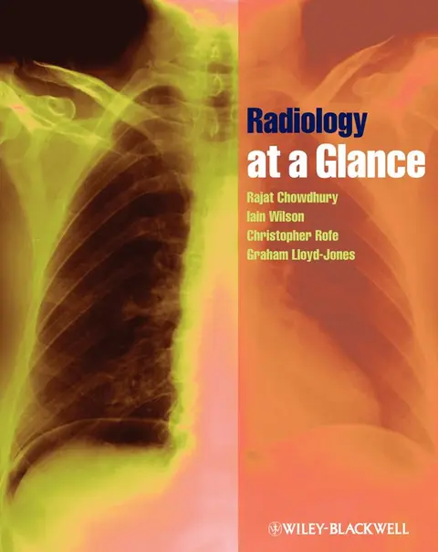 Cover of Radiology at a Glance