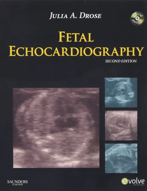 Cover of Fetal Echocardiography
