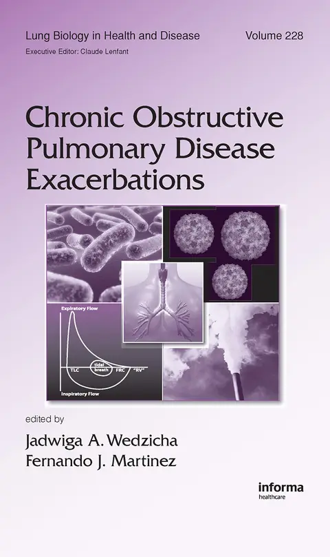 Cover of Chronic Obstructive Pulmonary Disease Exacerbations
